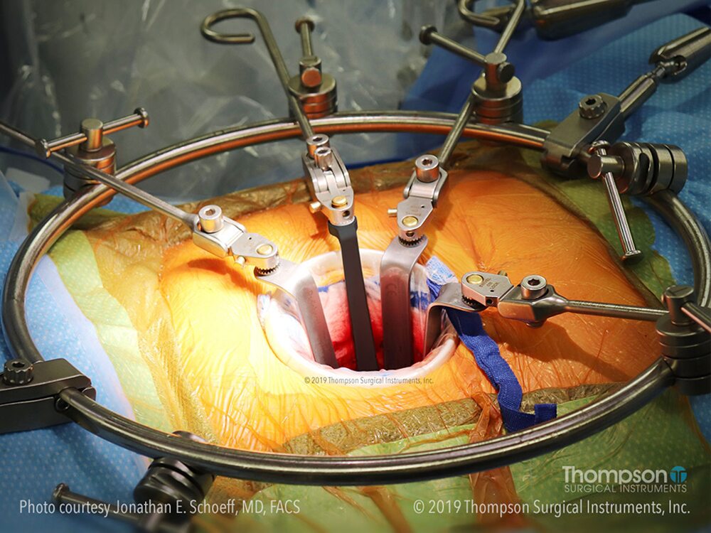 Doctors performing surgery under bright lights in an operating room