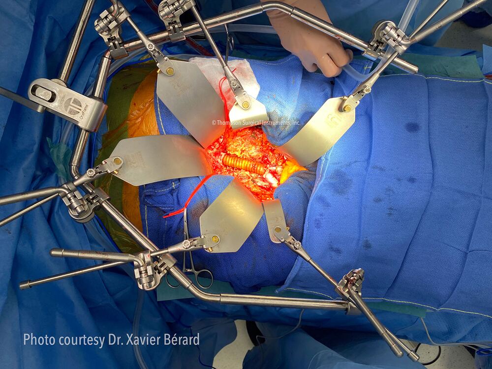 Doctors performing surgery under bright lights in an operating room